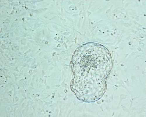 广州供卵试管婴儿哪家好,广州供卵包成功-有代生机构不