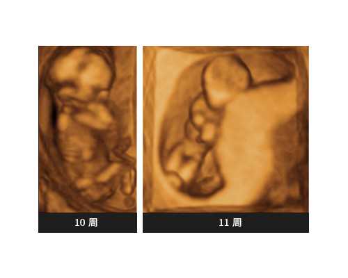 大班古诗登鹳雀楼教案(登鹳雀楼评课用语优缺点及建议)