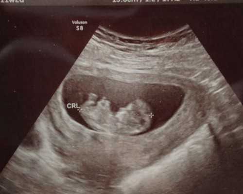 广东试管成功率高医院有哪些名单-广东试管婴儿医院排名最好的医院！