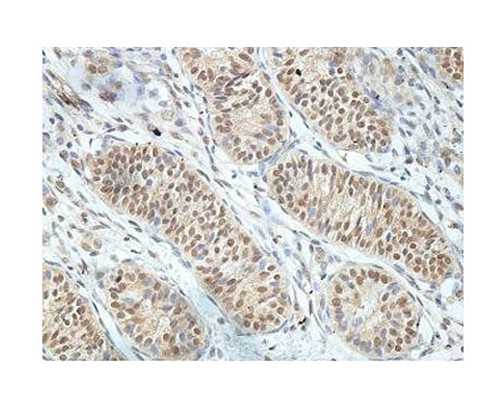 怀不上二胎的原因二胎怀不上的8大真相
