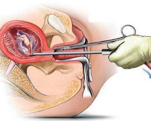 广州中山六院可以供卵,广州卵子库供卵费用清单?-专业代生小孩