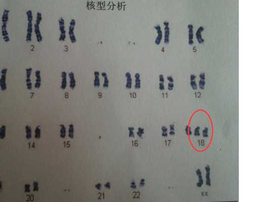 海孕试管供卵供精_供卵可以自己找吗,新乡供卵试管包男孩零风险（北京试管供