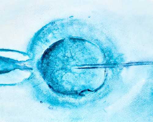 备孕二胎期间感染了hpv病毒还可利用试管技术助孕吗？